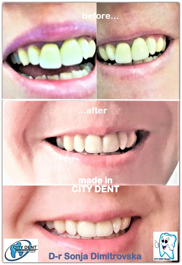 City Dent - City Dent