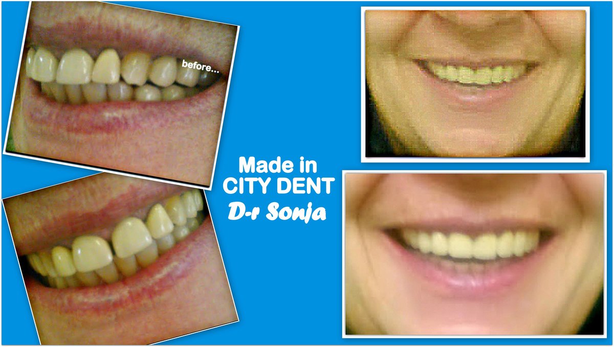 City Dent - City Dent