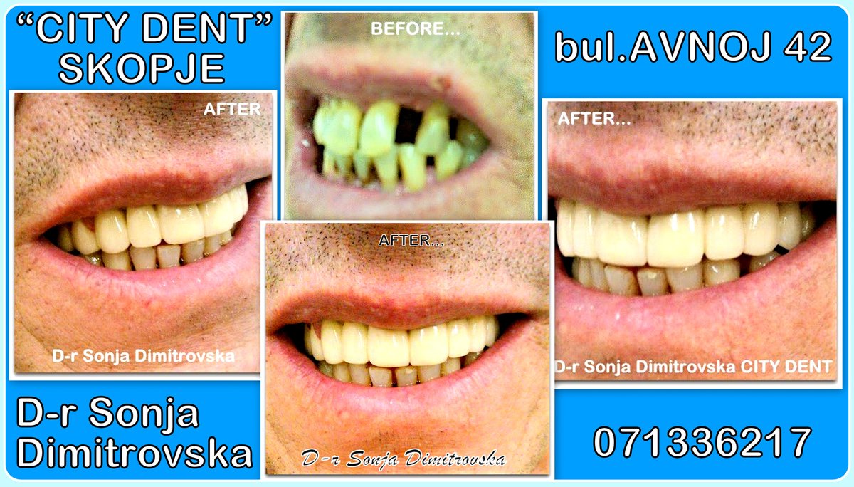 City Dent - City Dent