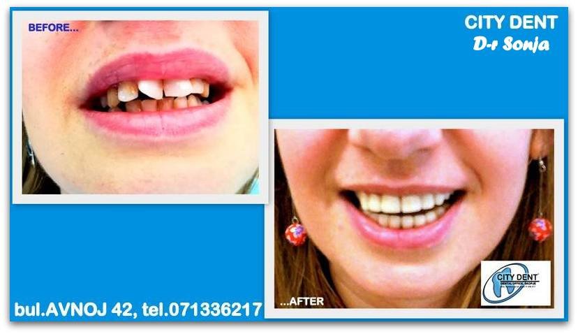 City Dent - City Dent