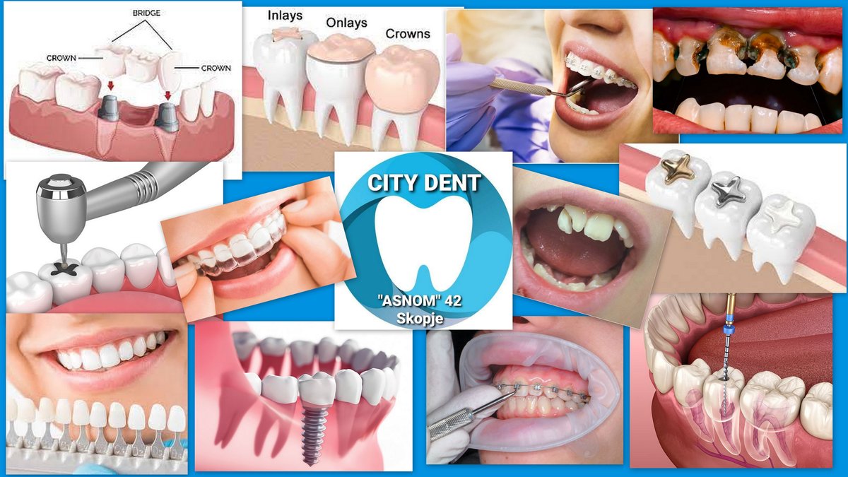 City Dent - City Dent