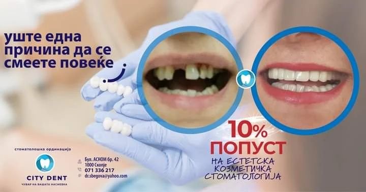 City Dent - City Dent