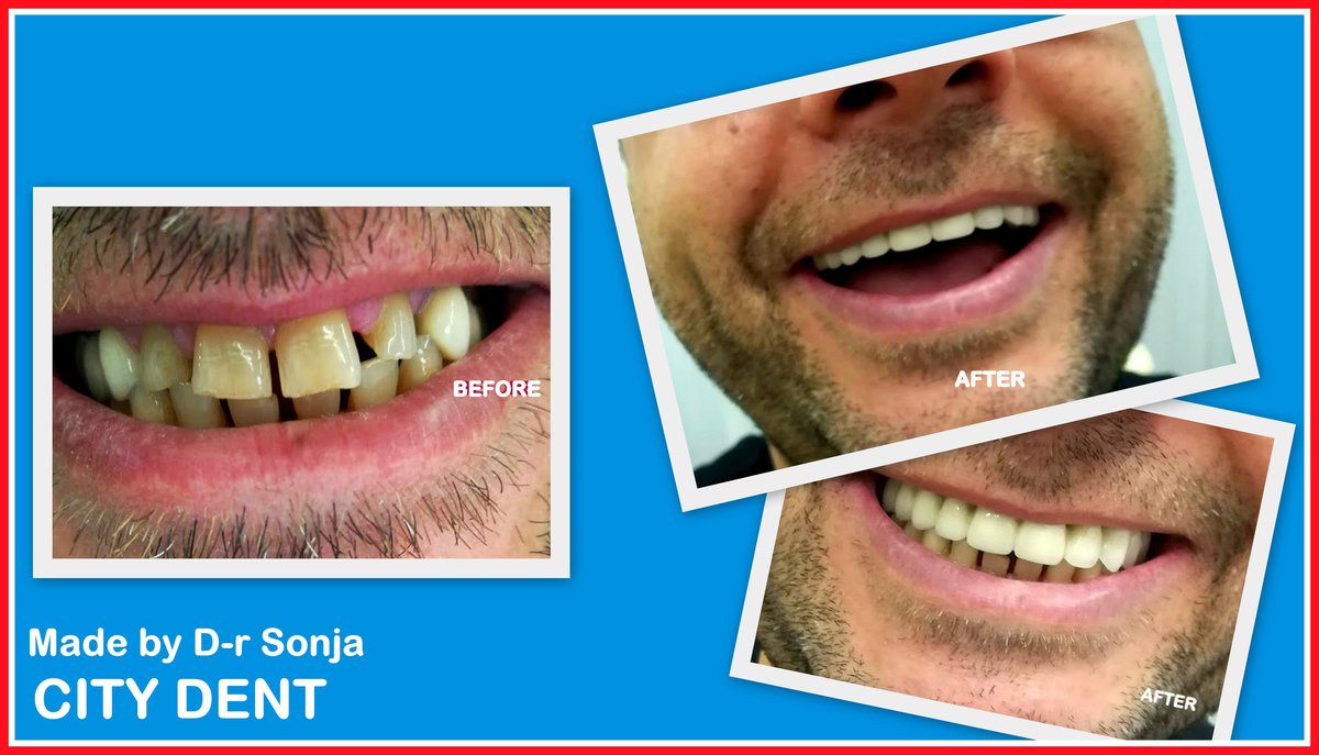 City Dent - City Dent