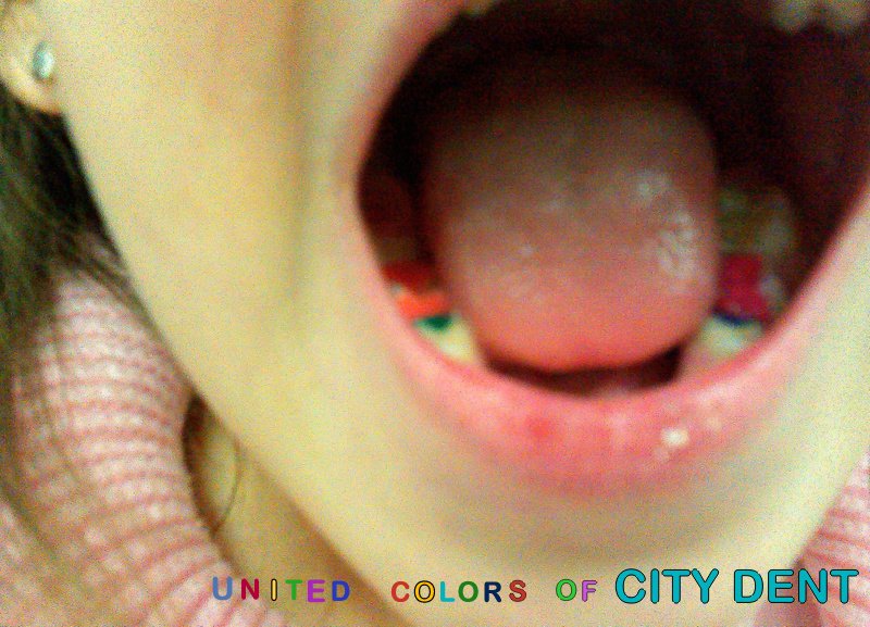 City Dent - City Dent