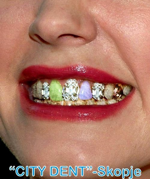 City Dent - City Dent