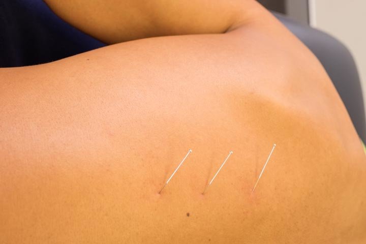 City Physiotherapy and Sports Injury Clinic - City Physiotherapy and Sports Injury Clinic