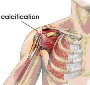 City Physiotherapy and Sports Injury Clinic - City Physiotherapy and Sports Injury Clinic