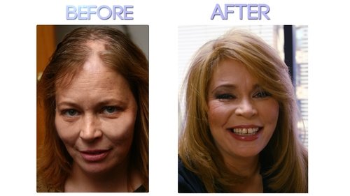Clara Alexander Clinic - Clara Alexander Clinic