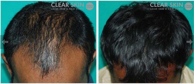 Clear Skin Clinic - Karad - Clear Skin Clinic - Karad