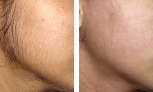 Clear Skin Clinic - Kolhapur - Clear Skin Clinic - Kolhapur