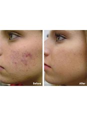 Clearskin Clinic - Clearskin Clinic