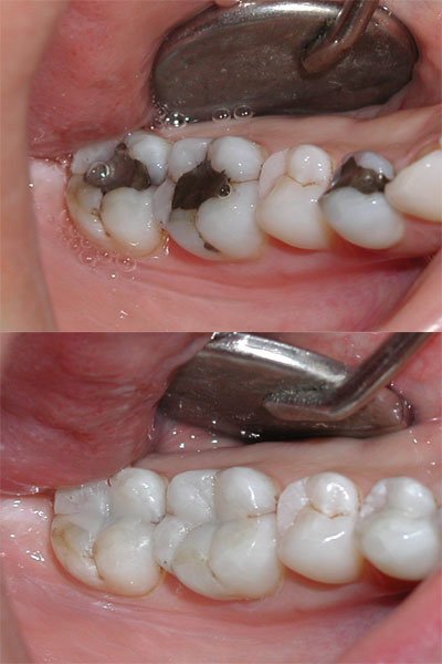 Cleopatra Dent - Cleopatra Dent