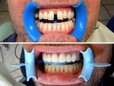 Cleopatra Dent - Cleopatra Dent