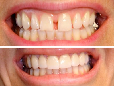 Cleopatra Dent - Cleopatra Dent