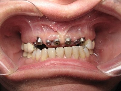 Cleopatra Dent - Cleopatra Dent