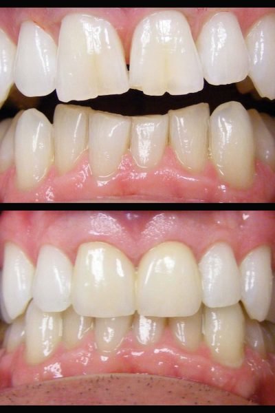 Cleopatra Dent - Cleopatra Dent