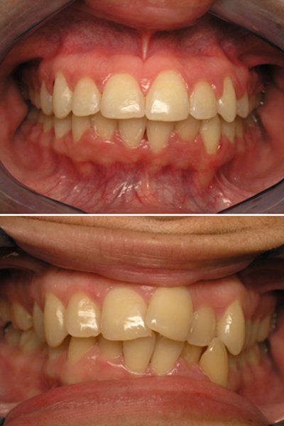 Cleopatra Dent - Cleopatra Dent