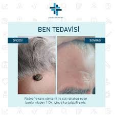 Climed - Bakirkoy - Climed - Bakirkoy