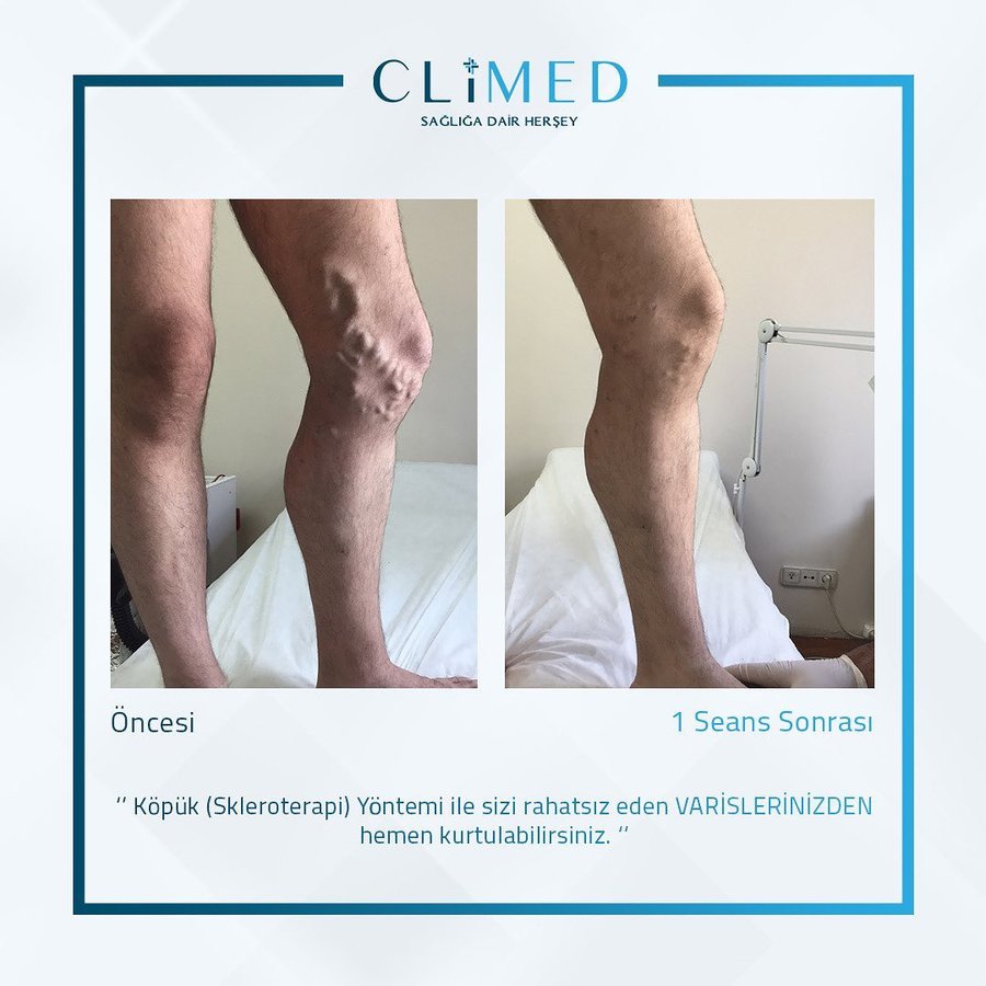 Climed - Kadikoy - Climed - Kadikoy