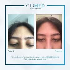 Climed - Climed