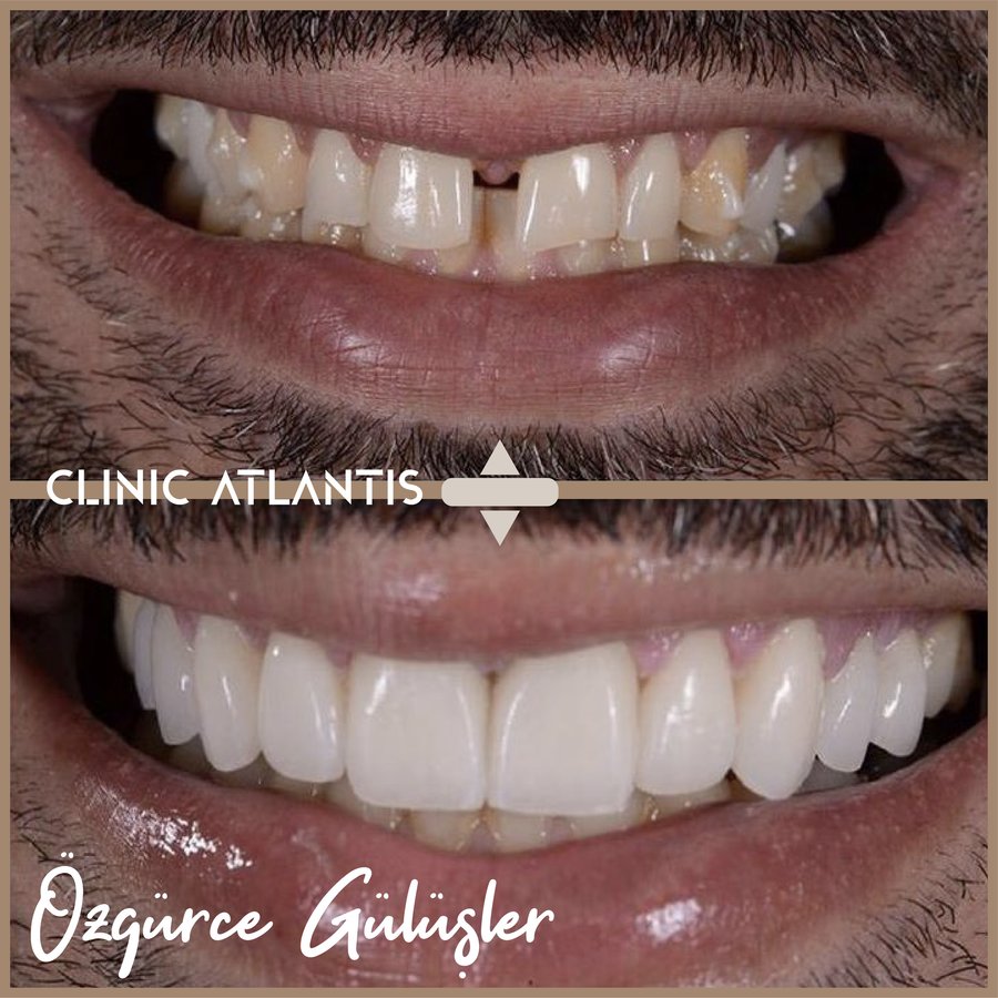 كلينيك أتلانتس - Clinic Atlantis