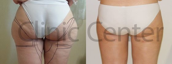 Clinic Center - Istanbul - Clinic Center - Istanbul