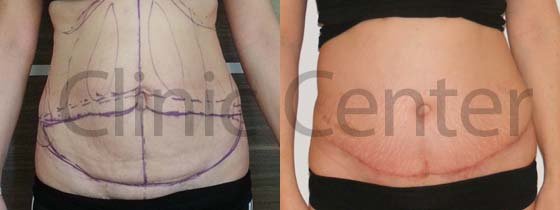 Clinic Center - Istanbul - Clinic Center - Istanbul