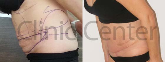 Clinic Center - Istanbul - Clinic Center - Istanbul