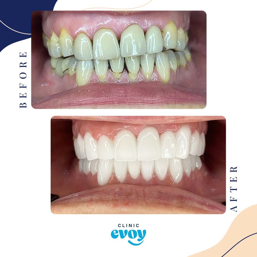 كلينيك إيفوي - Clinic Evoy