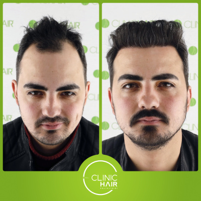 CLINIC HAIR  - Before After