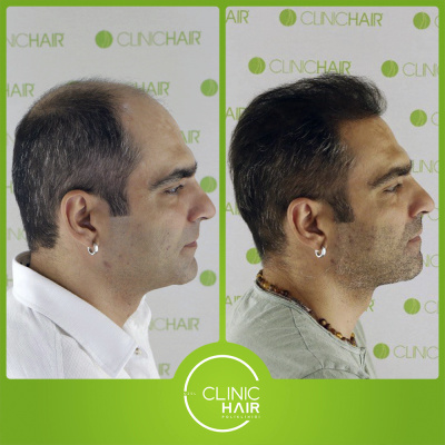 CLINIC HAIR  - Be Af