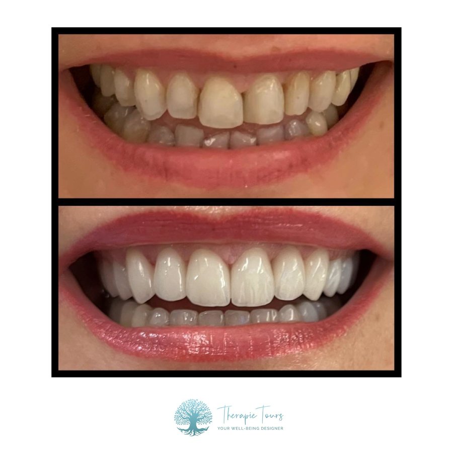 Clinic International Dentistry - Istanbul - Clinic International Dentistry - Istanbul