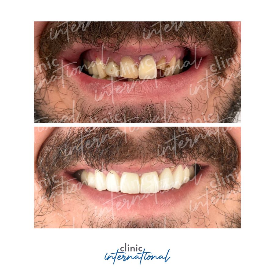 عيادة طب الأسنان الدولية - Clinic International Dentistry