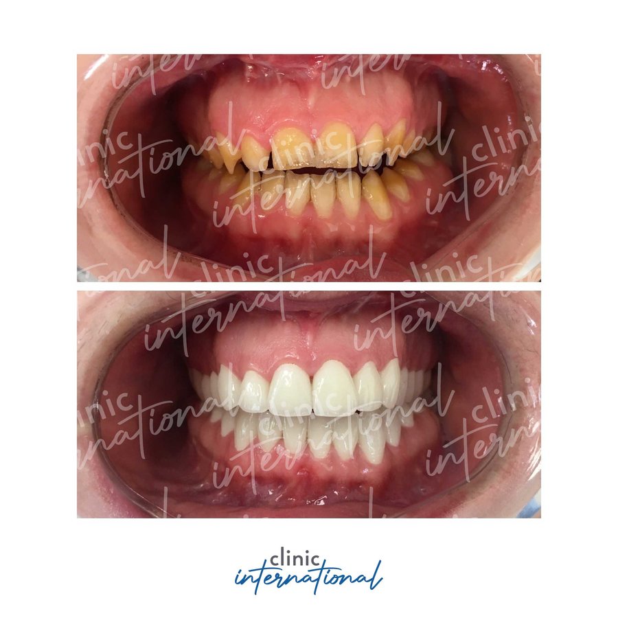 عيادة طب الأسنان الدولية - Clinic International Dentistry