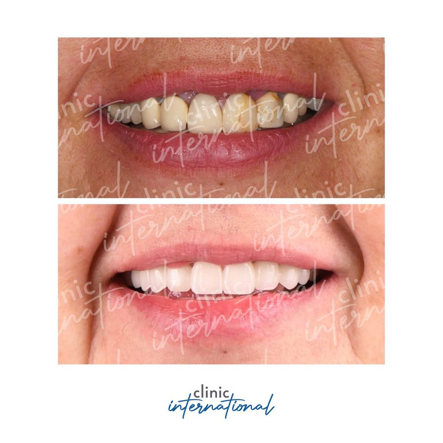 عيادة طب الأسنان الدولية - Clinic International Dentistry