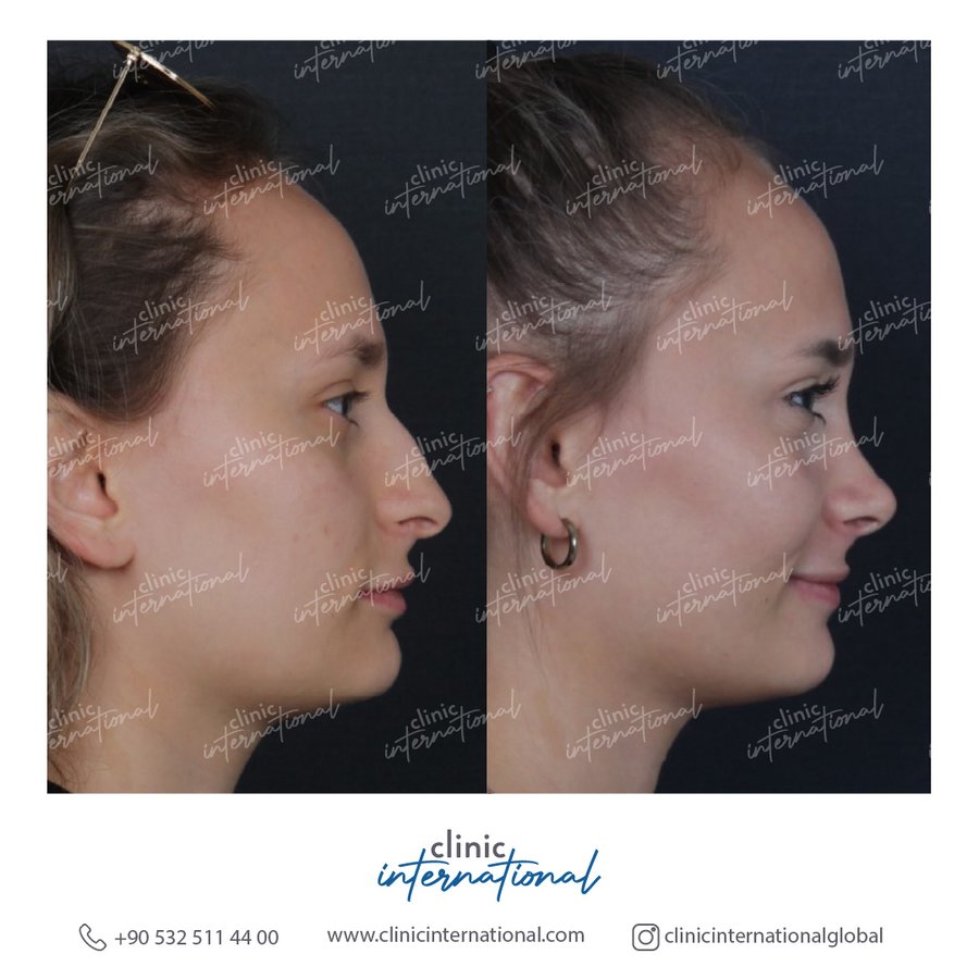 Clinic International İstanbul - Clinic International İstanbul