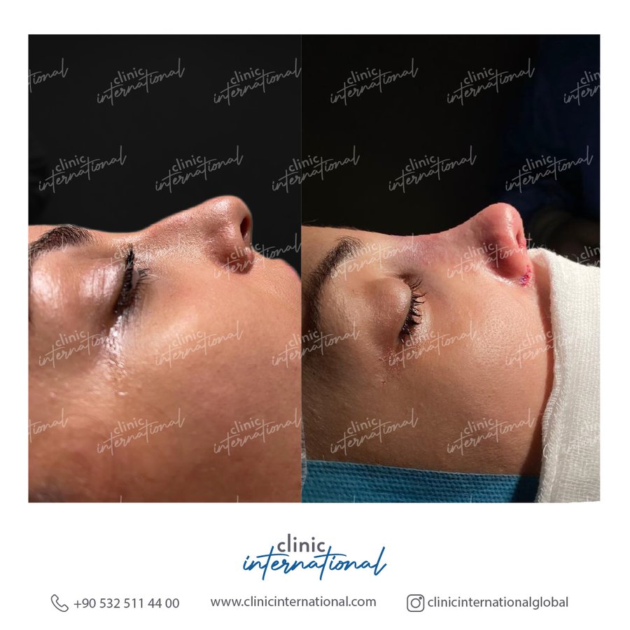 Clinic International İstanbul - Clinic International İstanbul