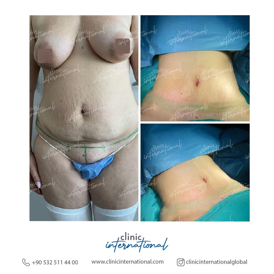 Clinic International İstanbul - Clinic International İstanbul