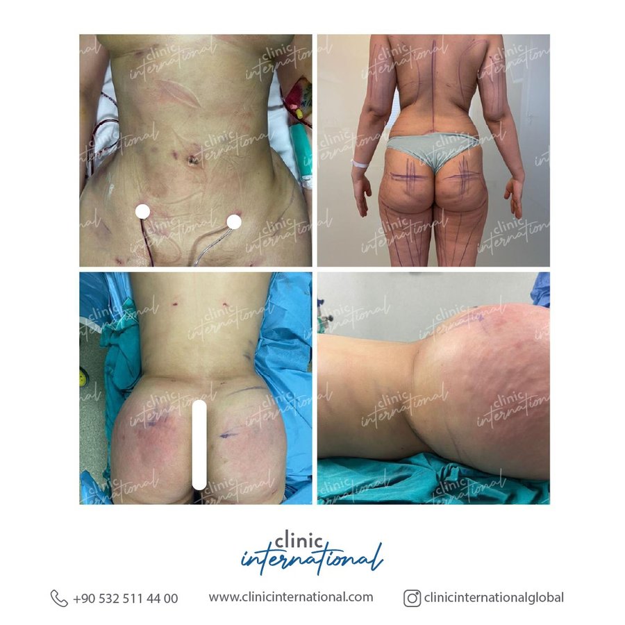 Clinic International İstanbul - Clinic International İstanbul