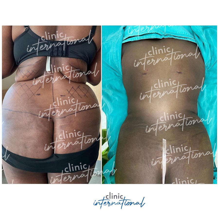 Clinic International İstanbul - Clinic International İstanbul