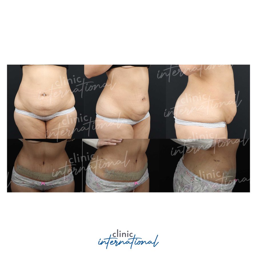 Clinic International İstanbul - Clinic International İstanbul