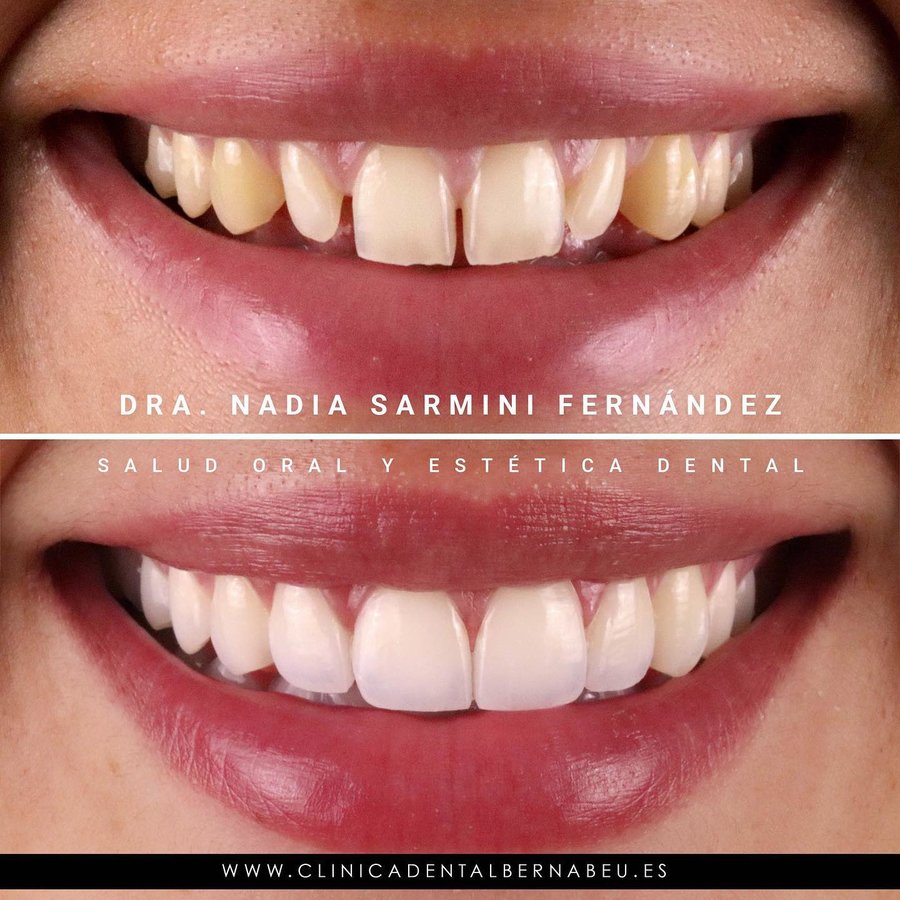 Clínica Dental Bernabeu - Clínica Dental Bernabeu