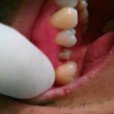 عيادة الأسنان مورينو شارتييه - فرع بافاس - Clinica Dental Moreno Chartier -Pavas Branch
