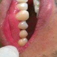 عيادة الأسنان مورينو شارتييه - فرع بافاس - Clinica Dental Moreno Chartier -Pavas Branch