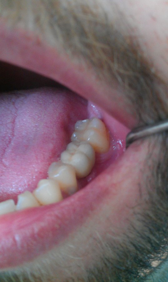 Clinica Dental Moreno Chartier - Clinica Dental Moreno Chartier