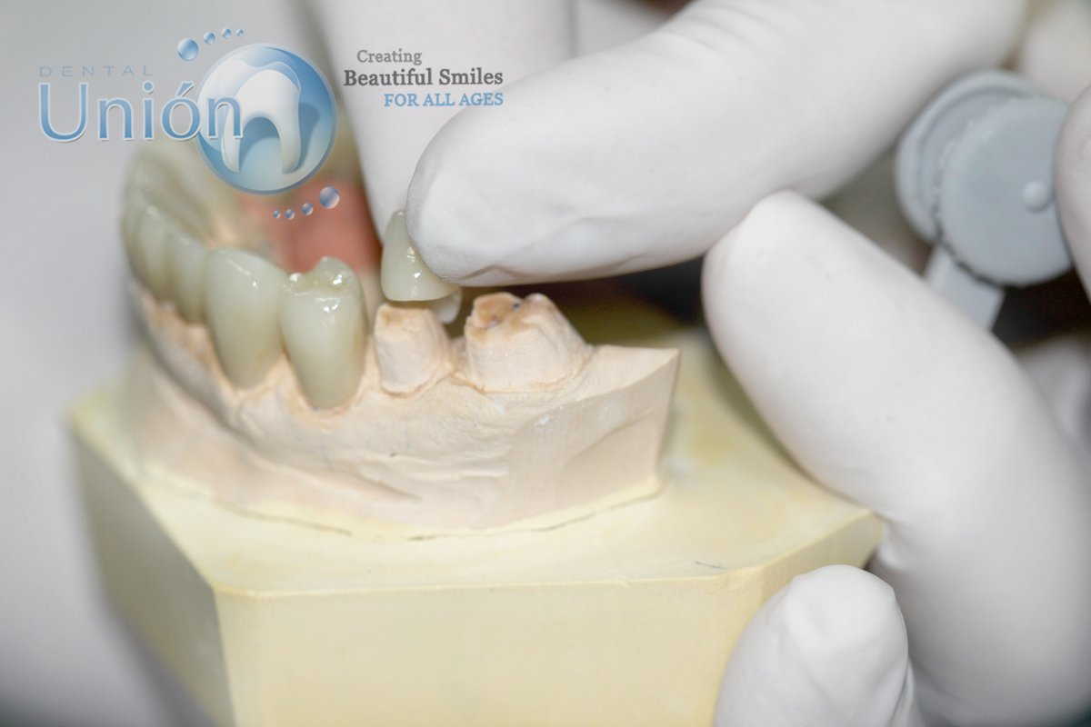 Clínica Dental Unión - Clínica Dental Unión