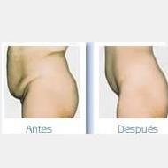 Clinica Laser De Piel Barrio Tequendama - Clinica Laser De Piel Barrio Tequendama