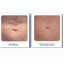 Clinica Laser De Piel - Clinica Laser De Piel