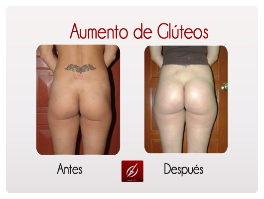 Clínica Láser Puebla - Clínica Láser Puebla