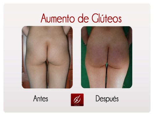 Clínica Láser Puebla - Clínica Láser Puebla